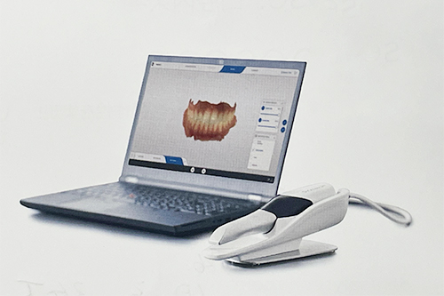 口腔内スキャナー