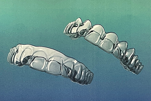 ＜矯正用マウスピース＞