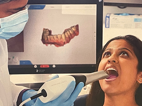 光学印象、マウスピース矯正